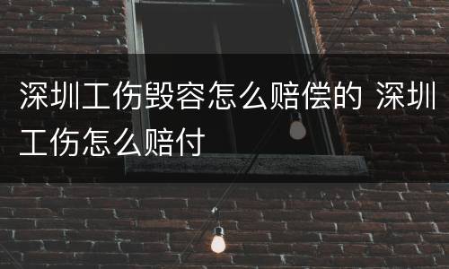 深圳工伤毁容怎么赔偿的 深圳工伤怎么赔付